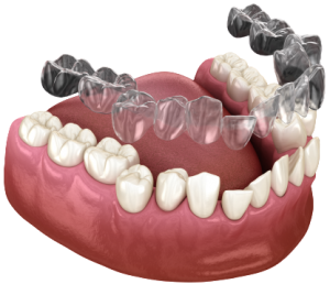 Şeffaf Plak fiyatları Şeffaf Plak fiyatları