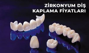 zirkonyum diş fiyatları zirkonyum diş fiyatları