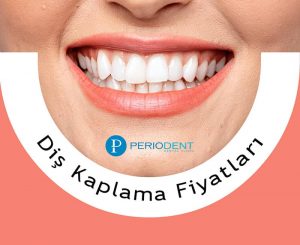 diş kaplama fiyatları