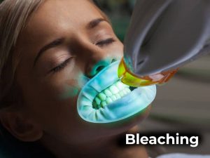bleaching