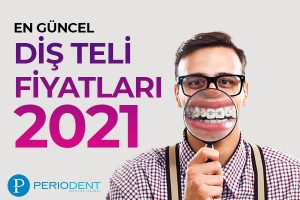 diş teli fiyatları 2021