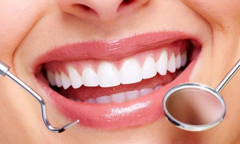 Bonding Diş Tedavisi Nedir?