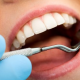 diş dolgusu nasıl yapılır