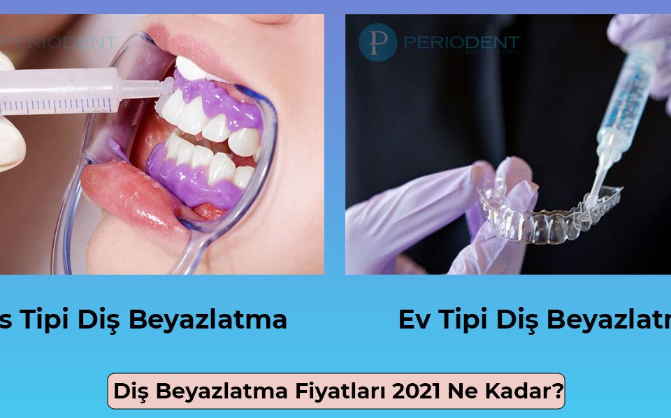 dis beyazlatma fiyatlari 2021