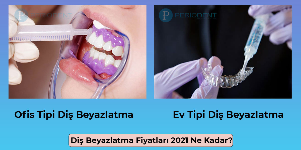 dis beyazlatma fiyatlari 2022