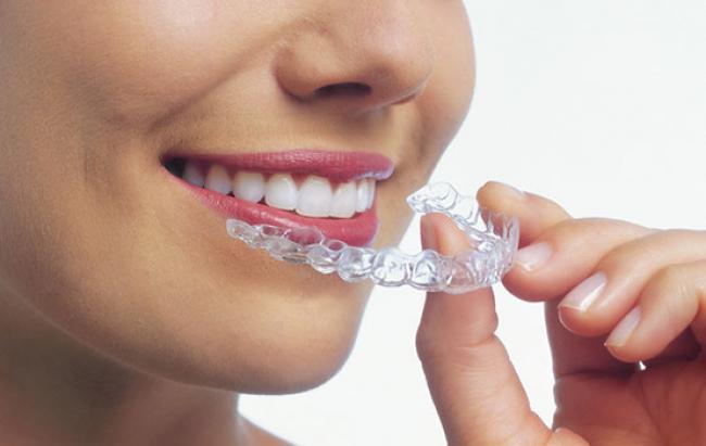 Invisalign fiyat