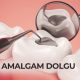 amalgam dolgu 1