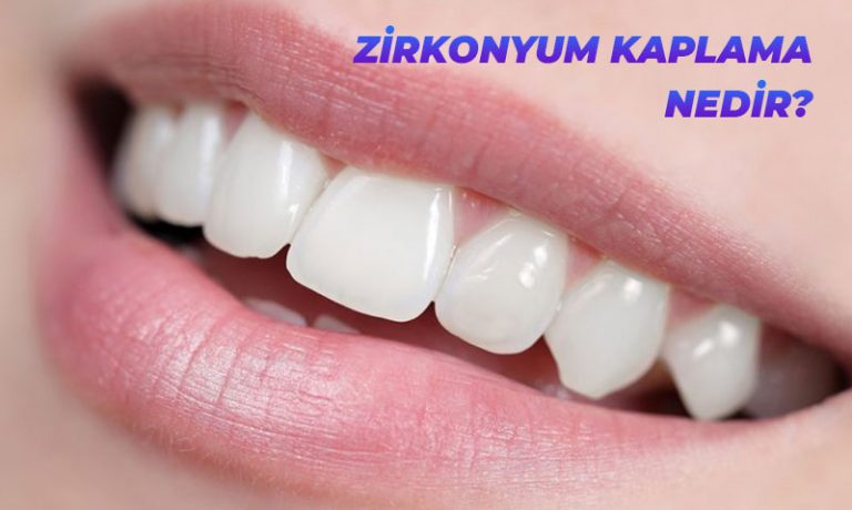 Diş Kaplama Nasıl Yapılır? Kaplama Diş Fiyatları Periodent