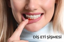 Diş Eti Çekilmesi Bitkisel Tedavi Evde ...