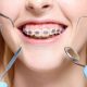 diş hekimi ve ortodontist arasındaki fark