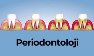 Periodontoloji