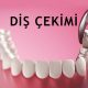 dis cekimi nedir