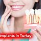 teeth implants turkey