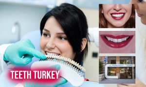 teeth turkey